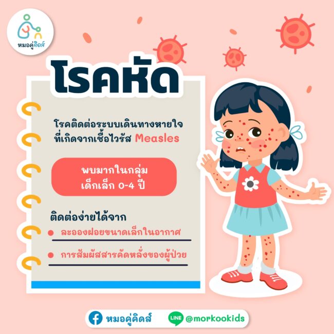 โรคหัดในเด็ก_3