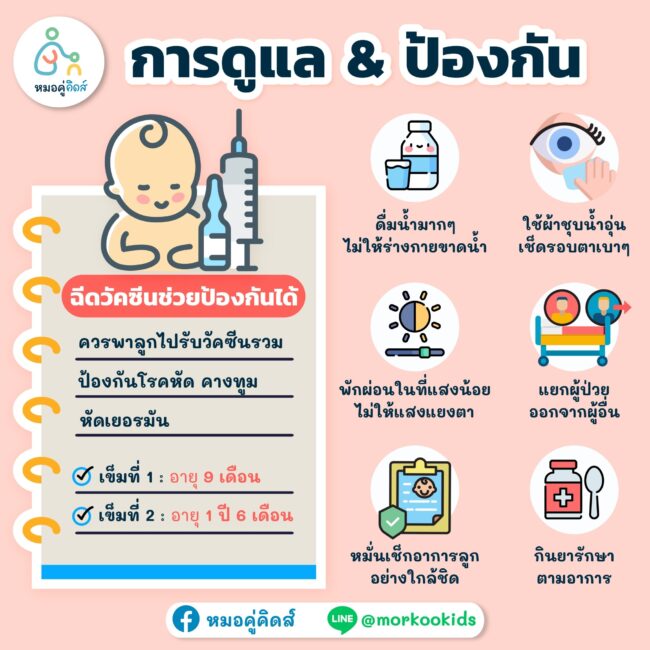 โรคหัดในเด็ก_5