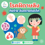 โรคฝีดาษลิงคืออะไร เกิดขึ้นกับเด็กได้ไหม