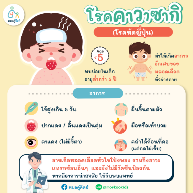 โรคคาวาซากิ