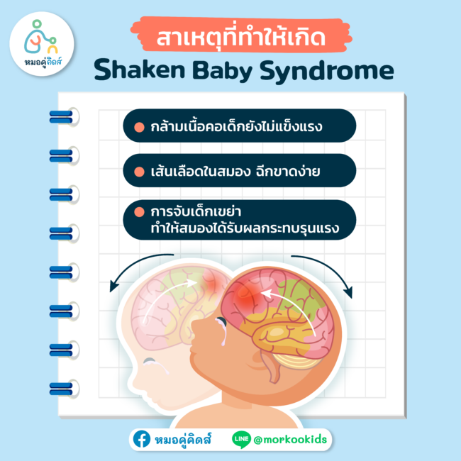 Shaken Baby Syndrome_4