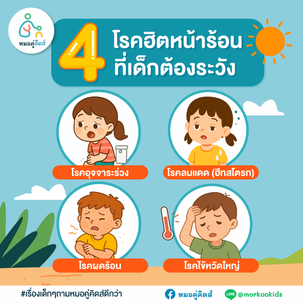 โรคหน้าร้อนในเด็ก