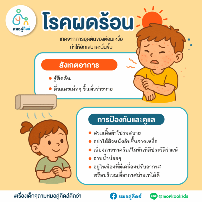 โรคผดร้อนในเด็ก