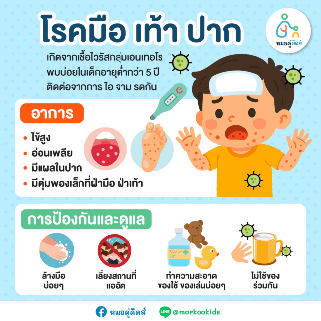ระวัง โรคมือ เท้า ปาก หน้าฝน
