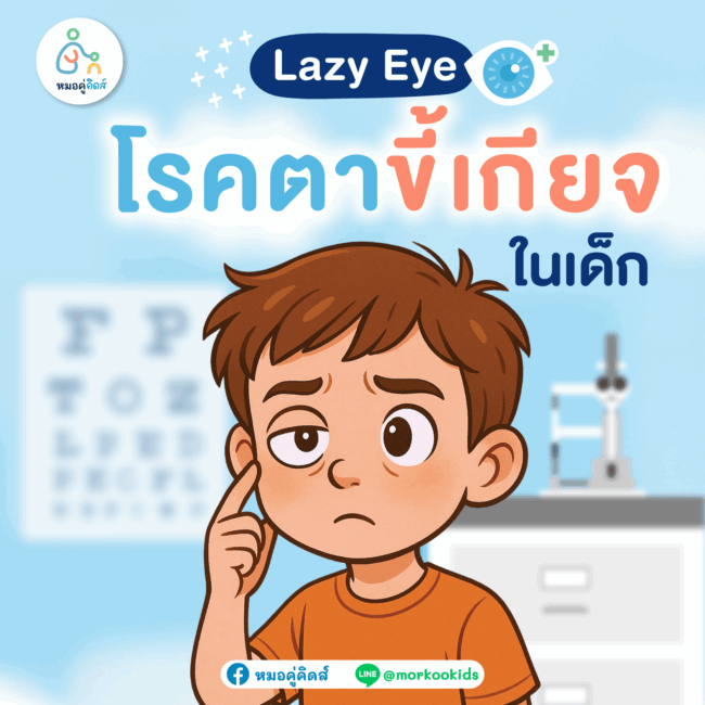 โรคตาขี้เกียจในเด็ก