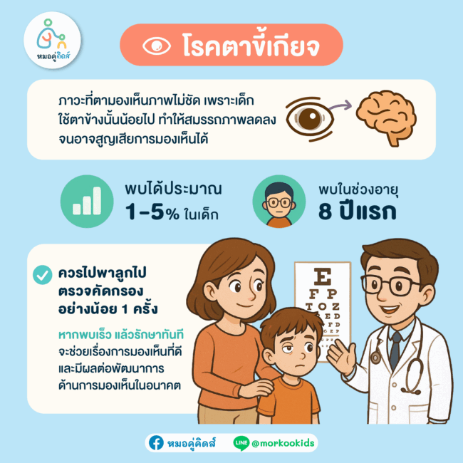 โรคตาขี้เกียจในเด็ก คืออะไร
