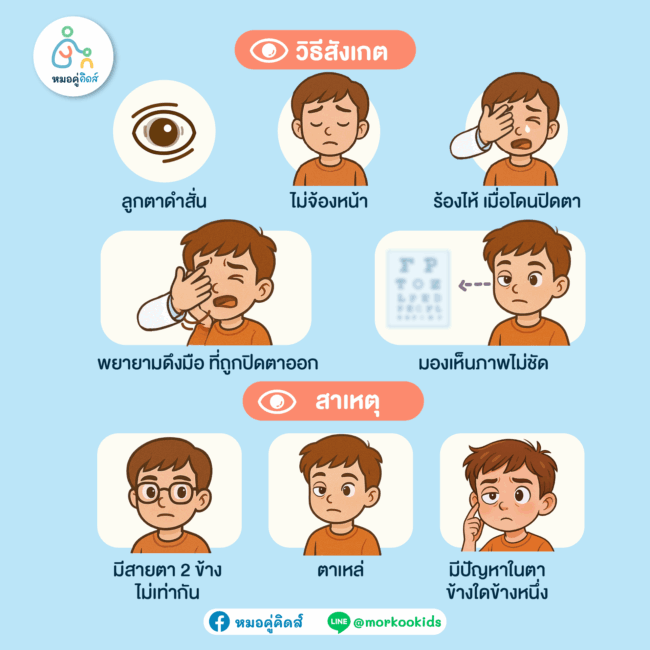 สาเหตุและวิธีสังเกตโรคตาขี้เกียจในเด็ก